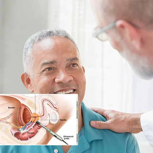 Customizing Penile Implant Surgery to Patient Age