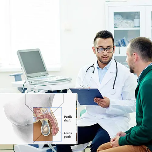 Unveiling the Newest Advances in Penile Implants