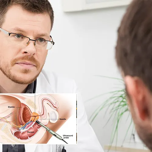 Welcome to  High Pointe Surgery Center 
: Understanding Your Options for Erectile Dysfunction Treatment